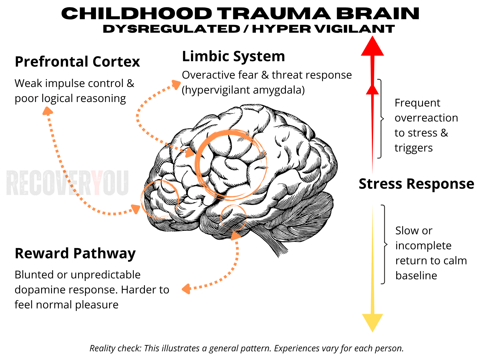 Illustration of how childhood trauma reshapes brain development
