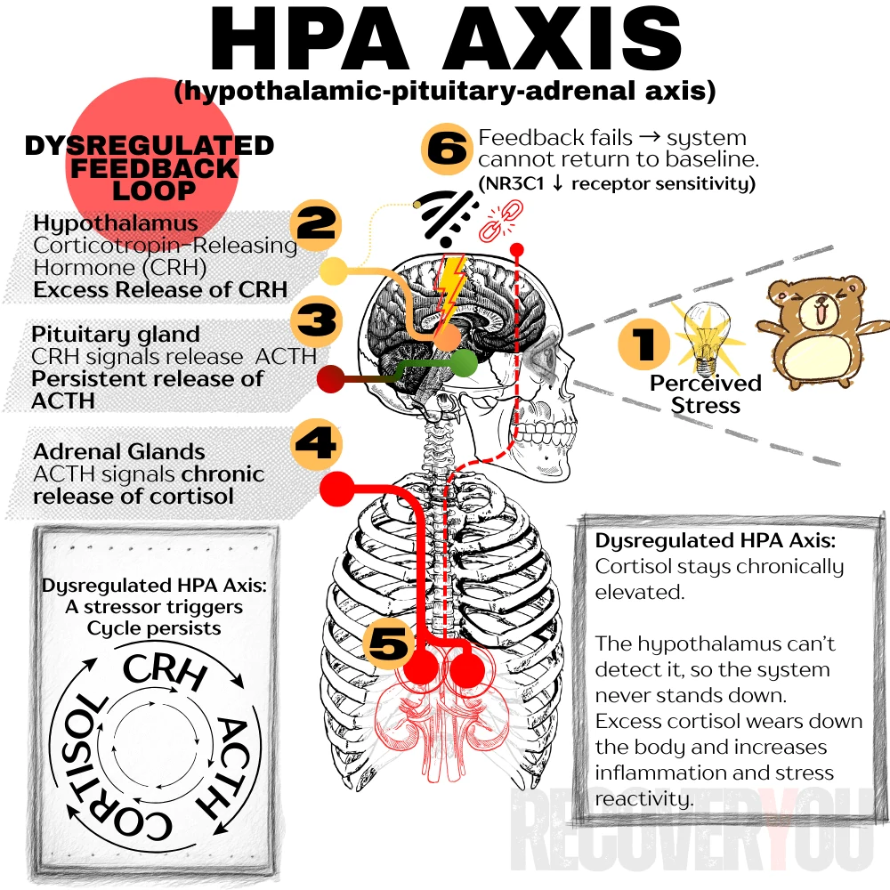 Diagram of a dysregulated HPA axis: excess CRH release, persistent ACTH, and chronically elevated cortisol. The feedback signal fails because of reduced NR3C1 receptor sensitivity, so the system cannot return to baseline.